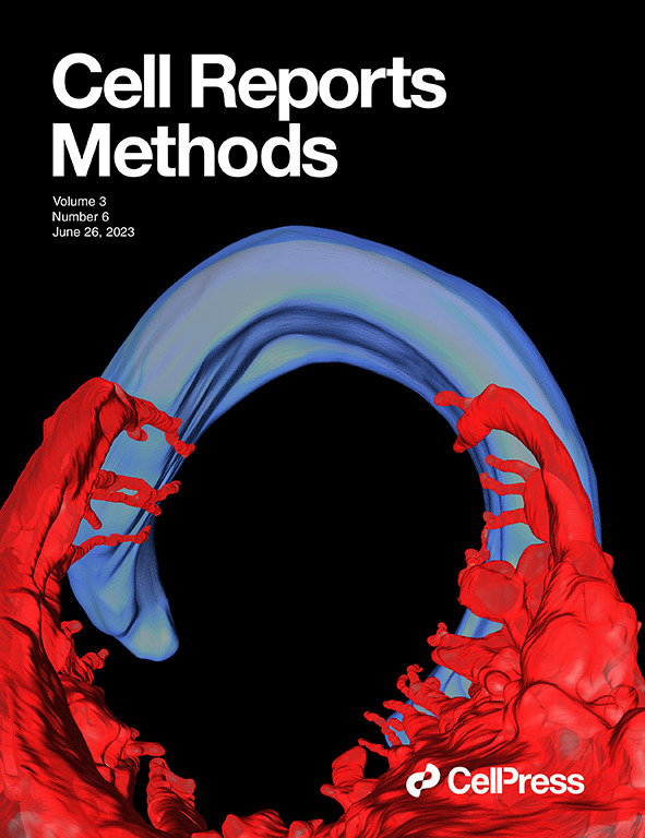 DiI-CT—A bimodal neural tracer for X-ray and fluorescence imaging